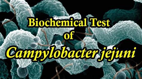 Biochemical Test of Campylobacter jejuni