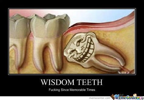 25 Wisdom Teeth Memes That Are Too Funny For Words - SayingImages.com