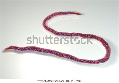 51 Onchocerciasis Images Stock Photos And Vectors Shutterstock