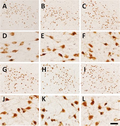 Mt Ii And Leptin Induced C Fos On Orexin Neurons Representative