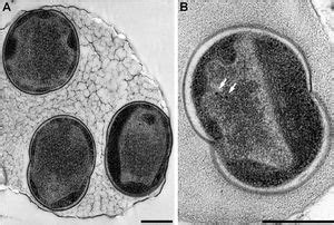 Alcanivorax borkumensis - microbewiki