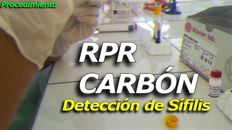 Guía Completa Para la Detección de Sífilis con RPR CARBÓN Entendiendo