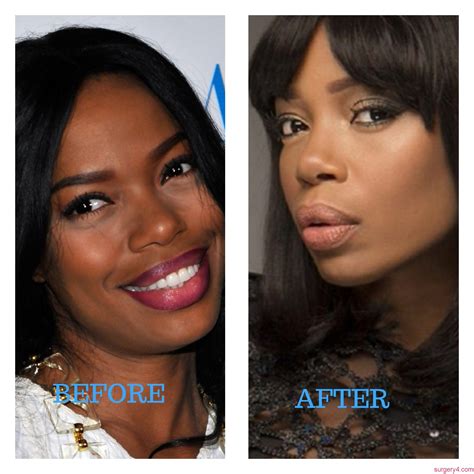 Jill Marie Jones Plastic Surgery Photos Before And After Surgery4