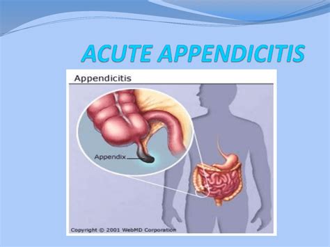 Vermiform Appendix Definition