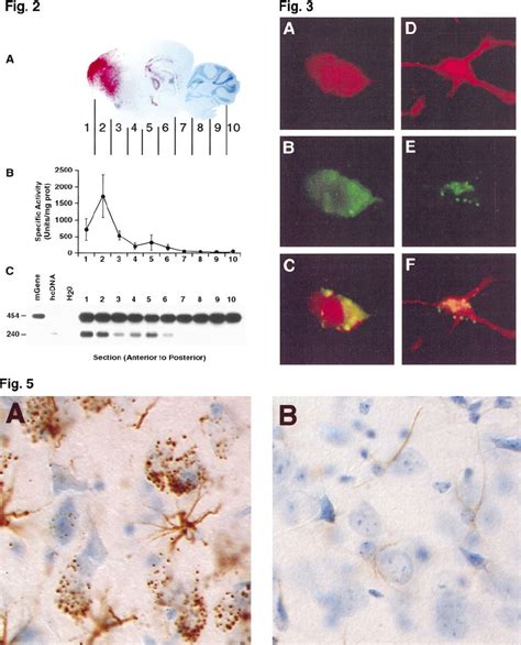 Gusb Activity And The Recombinant Aav Genome Are Concentrated Near The