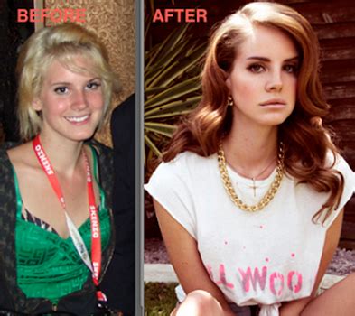 Lana Del Rey Before And After