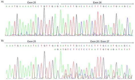 Cdna Sequence Chromatograms Panel A Showing Sanger Sequencing Of A