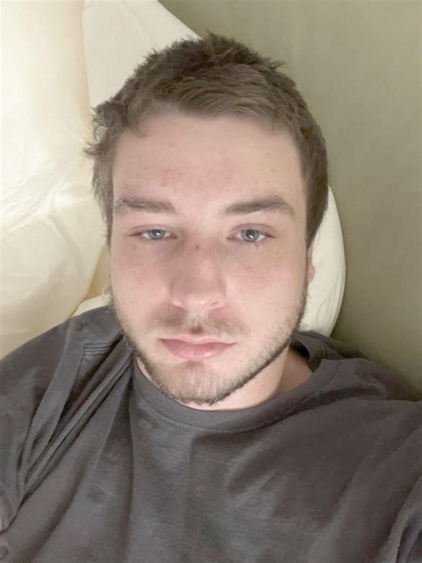 how to fix facial asymmetry 8