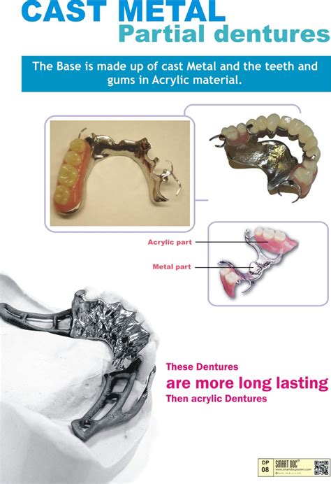 Cast metal partial dentures (Eng.)DP-08 | Smart Doc Posters