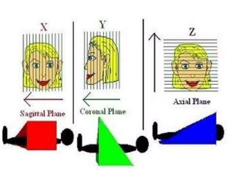 Mri coils | PPT