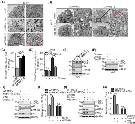 TRIM11 Inhibits Glucose Deprivationinduced Autophagy Stimulation