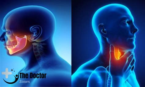 Head and Neck Cancer Treatment: Navigating the Path to Recovery ...