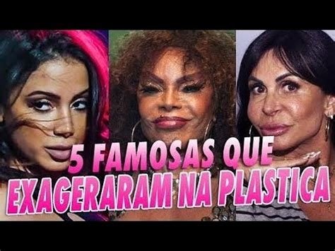 Famosas Do Brasil Que Exageraram Na Plastica Youtube