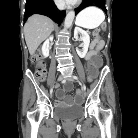 Images Radiopaedia Org