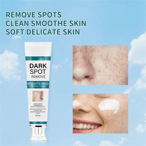 Dark Remover And Pimple Marks Uneven Skin Tone And Removal Oily Face Bio Complete Eyelid