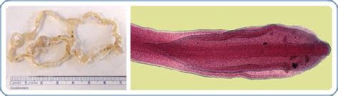 Themes Of Parasitology Diphyllobothrium Latum A Very Macroscopic Parasite