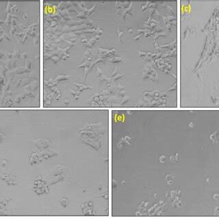 representative morphological   hct  cells