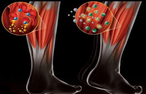 Ecco Qui Alcuni Rimedi Per Alleviare Il Dolore Causato Dall Acido Lattico