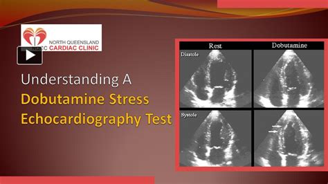 Ppt Understanding A Dobutamine Stress Echocardiography Test