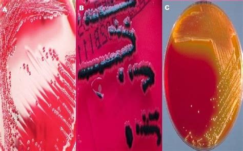 Gemidos Regreso Cruel Colonias De Shigella Enciclopedia Brillar Construir