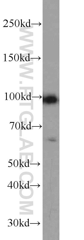 Atf4 Antibody 10835 1 Ap Proteintech