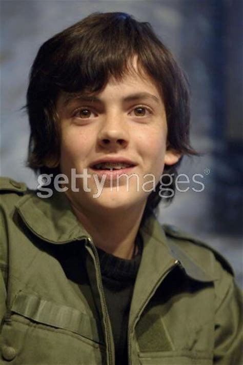 Skander With Braces Skandar Keynes Photo Fanpop