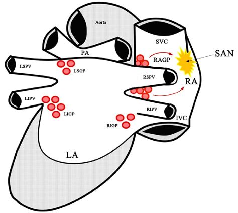 Anatomy of ganglionated plexi related to the pulmonary veins and the ...