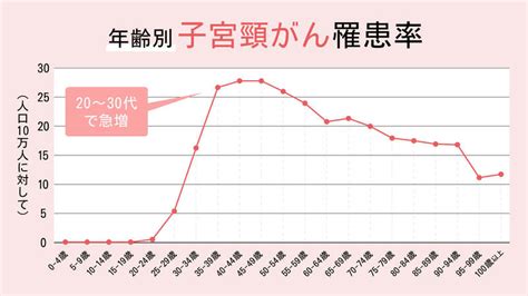 婦人科検診（子宮頸がん・子宮体がん検査）｜上野駅前婦人科クリニック