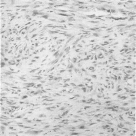 Low Power View Of A Haematoxylin And Eosin Stained Section Of The Download Scientific Diagram