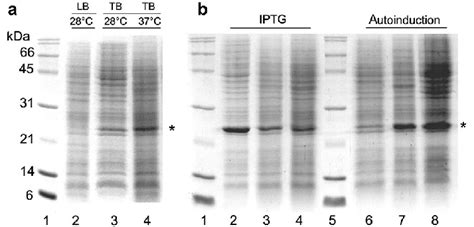 Expression Of Srh Dr5 B Protein In E Coli Strains Samples Containing