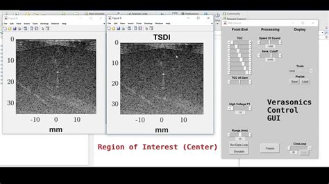 Ultrasound Imaging For Needle Tracking Multi Region YouTube