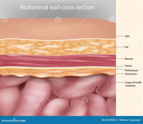 Abdominal Wall Cross Section Anatomy. Abdominal Wall Layers Cartoon ...