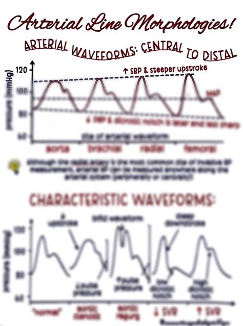 The Arterial Line ABP Waveform - Etsy