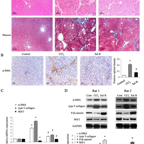 Sal B Significantly Ameliorated Ccl 4 Induced Liver Fibrosis In Rats