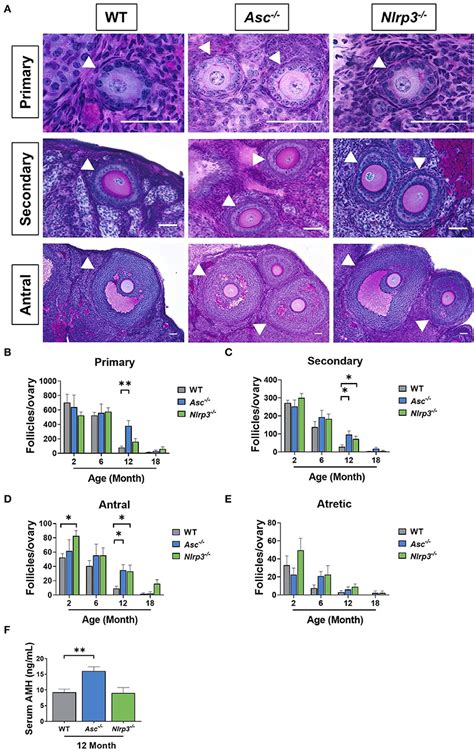 Frontiers The Inflammasome Contributes To Depletion Of The Ovarian