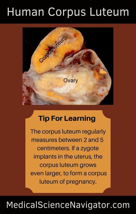 The Corpus Luteum Of The Human Ovary Is A Structure Much Larger Than