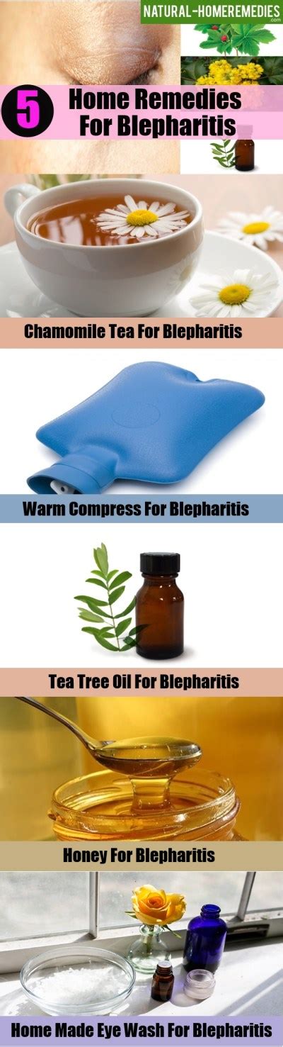 5 Home Remedies For Blepharitis Natural Treatment And Cure For