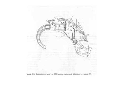 Hearing aid anatomy Diagram | Quizlet