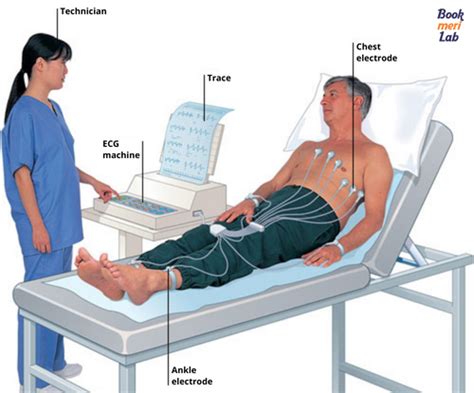 ECG Test Purpose, Procedure, Sample Report & Price [2025]