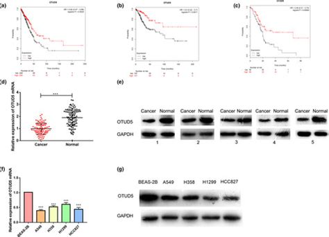 Otu Deubiquitinase Inhibits The Progression Of Nonsmall Cell Lung