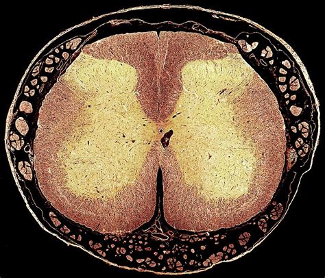 Spinal Cord Photograph By Steve Gschmeissnerscience Photo Library