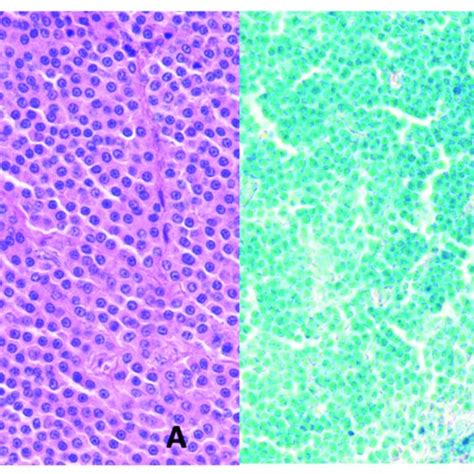 A Low Grade Mast Cell Tumor In A Cat Cat N12 Round Neoplastic