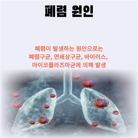 폐렴 전염기간 폐렴 전염되나요 초기증상까지아기 네이버 블로그