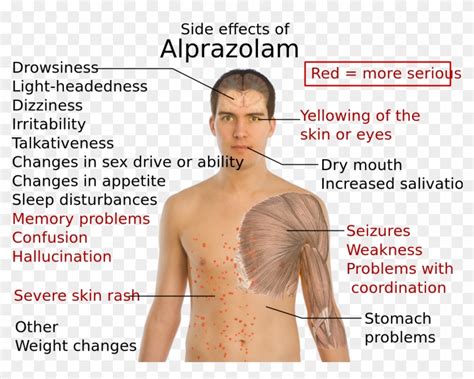 Side Effects Of Alprazolam - Xanax Rash Side Effects, HD Png Download ...