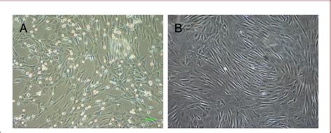 Morphology Of Bone Marrow Mesenchymal Stem Cells Cultured In Vitro Download Scientific Diagram