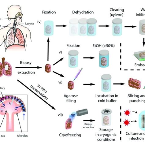 Lung Biopsy Extraction Preparation And Mounting For Xpct I Download Scientific Diagram