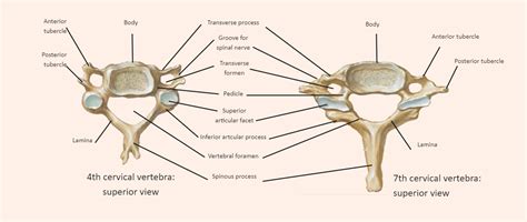 Cervical Vertebrae Labeled EdrawMax Template