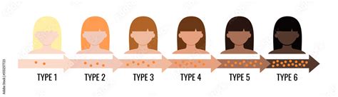 Fototapeta Fitzpatrick Skin Tone Phototype Melanin Index Chart With