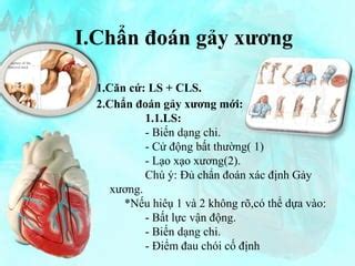 B dc gay xuong BỆNH NGOẠI KHOA PPT