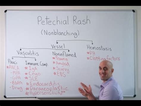 Petechial Rash - Approach - YouTube